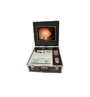 普通一体式彩色红外乳腺诊断仪 ZJ-8000B