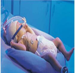 阿拉丁新生儿呼吸机 ARABELLA