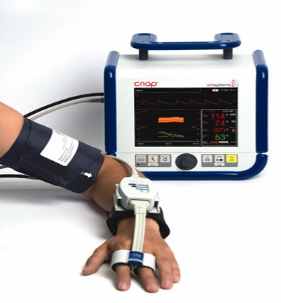 CNAP无创连续心排量及血流动力学检测
