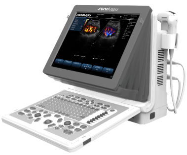 乐普便携式超声诊断仪 LP7 Plus