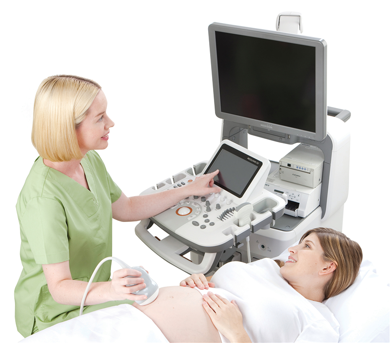 三星麦迪逊Accuvix XG超声