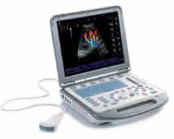 M5 便携式彩色多普勒超声系统