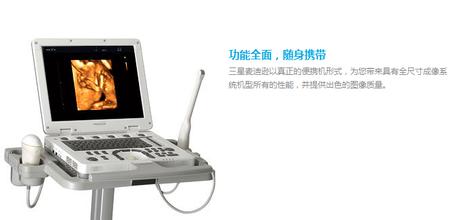 三星麦迪逊MySono U5便携式超声诊断仪