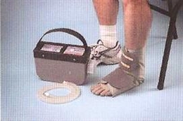 英国CRYO-1冰疗仪