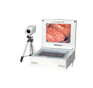 便携式电子阴道镜 LC-9100B
