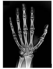 数字X光骨龄机 AMW HB-101