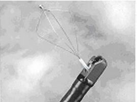 大钳道 广角 头端射水装置 治疗型 ED-450XT5