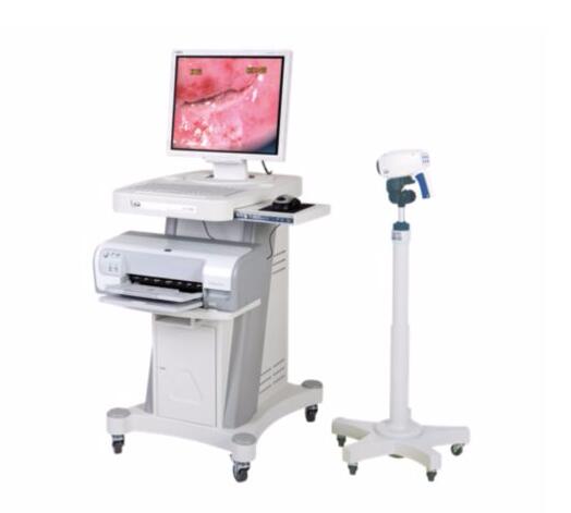 飞利浦SLC-1000B电子阴道镜数字成像系统