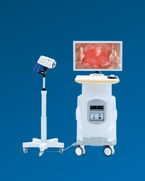 飞利浦新一代SLC-2000B电子阴道镜数字成像系统