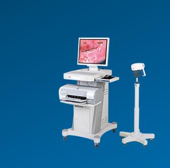 飞利浦新一代SLC-1000B电子阴道镜数字成像系统