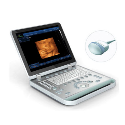 笔记本式4D(四维)B超 SS-10Plus