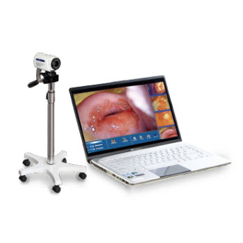 TR6000B数码电子阴道镜【笔记本便携式】