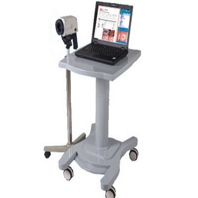 数码电子阴道镜(便携式) KY-130