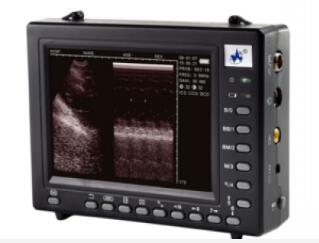 威尔德wed-2000a掌上全数字超声诊断系统