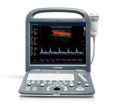 S2N 全新彩色多普勒超声诊断系统