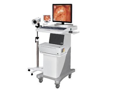 亿康盈联数码电子阴道镜EK-6000C(标准双屏)