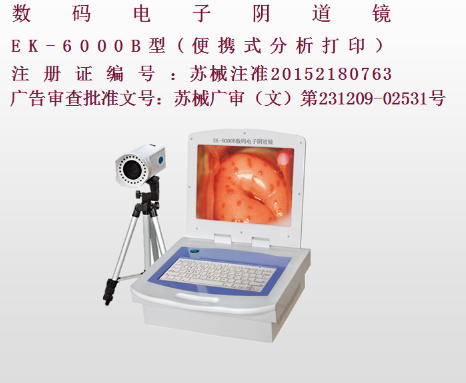 亿康盈联数码电子阴道镜EK-6000B(彩色液晶分析打印)