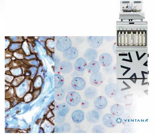 巴瑞自动染片机BenchMark GX