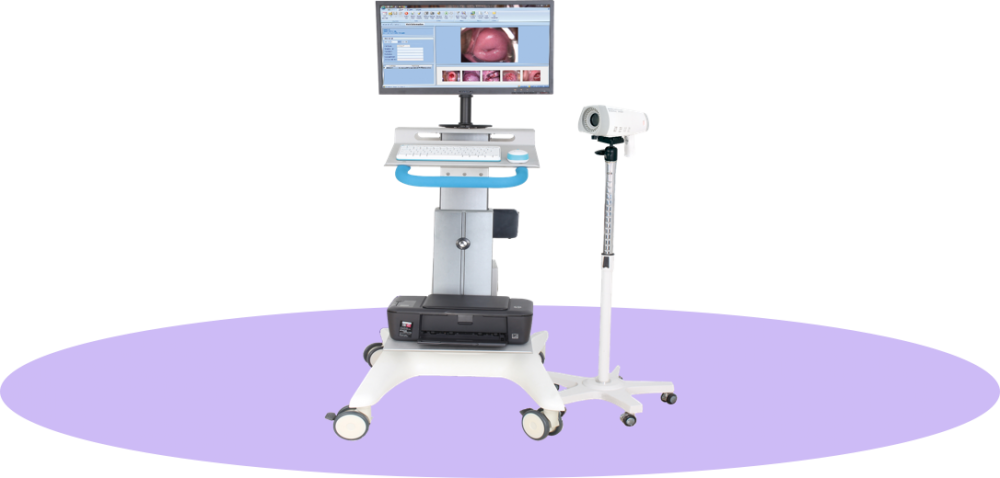 经典款 数码电子阴道镜