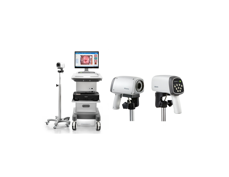 理邦C6电子阴道镜