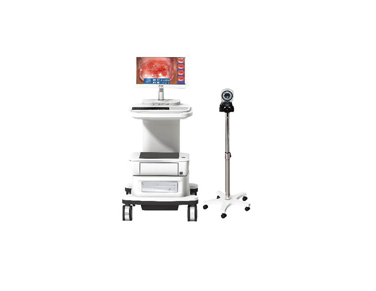 TR6000C数码电子阴道镜