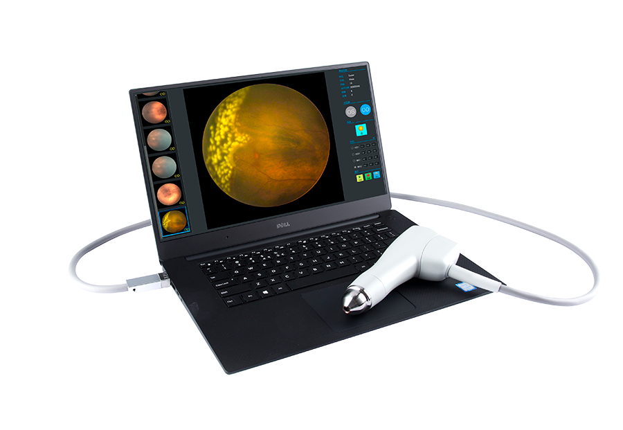 索维眼科广域成像系统SW-8000P