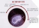 幽门螺杆菌检测原理：13C尿素呼气检测的优点与应用