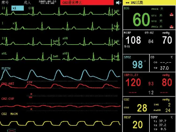 心脏监测仪1.png