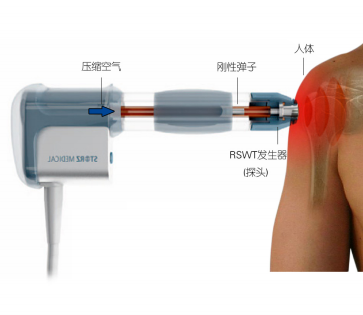疼痛治理仪.png 疼痛治理仪.png