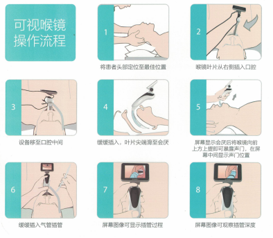 可视喉镜