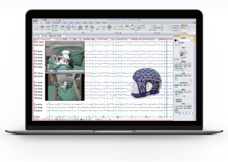 振幅视频脑电图机