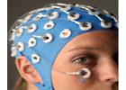 EEG-fMRI: 脑功能评估的重要交叉技术