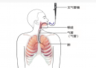 详细介绍支气管镜的操作流程和清除效果