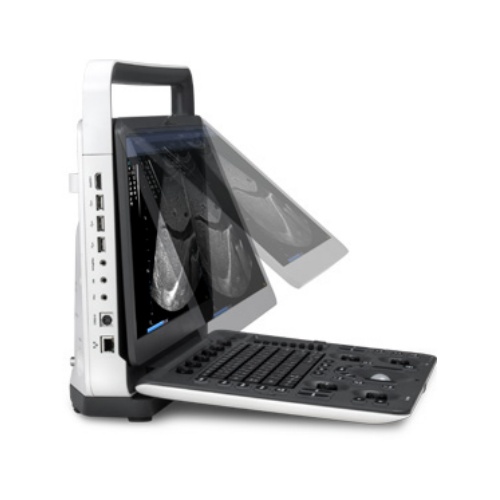 开立便携式彩色多普勒超声诊断系统E2