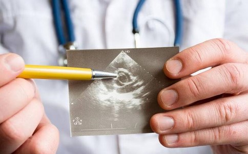 阴道B超 阴道B超