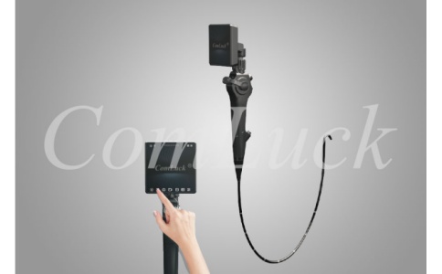 可视软性喉镜 可视软性喉镜