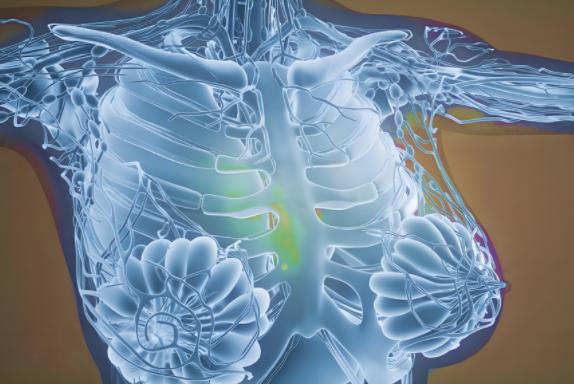 乳腺弹性成像准确吗 乳腺弹性成像准确吗