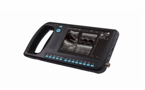 掌上超声诊断仪 掌上超声诊断仪