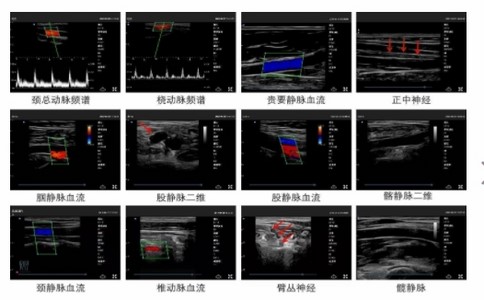 思多科掌上超声诊断仪.jpg 思多科掌上超声诊断仪.jpg