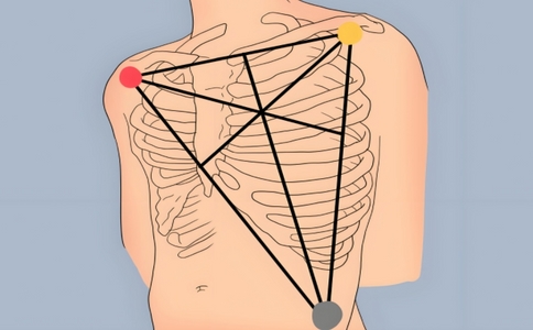 动态心电图7个位置.jpg 动态心电图7个位置.jpg