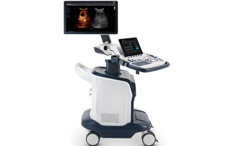 开立彩超 开立彩超