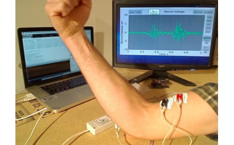 肌电图 肌电图