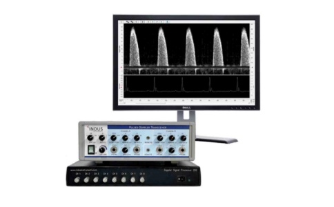 血流探测仪 血流探测仪