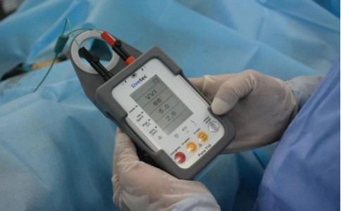 临时起搏器 临时起搏器