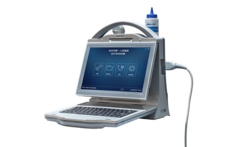 骨密度仪 骨密度仪