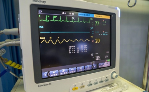 遥测心电监护 遥测心电监护