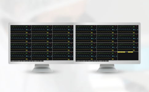 中央监护系统 中央监护系统