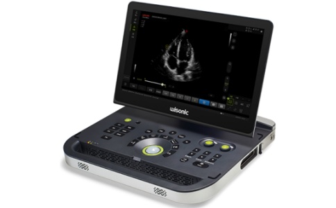 彩色多普勒超声系统 彩色多普勒超声系统