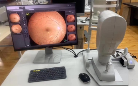 眼底相机 眼底相机