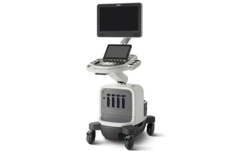 超声诊断系统 超声诊断系统